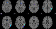 Ultramarathons May Briefly Shrink Your Brain, According To Science