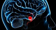 What Is an Aneurysm? Types and Causes